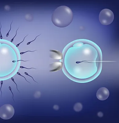 Intra Cytoplasmic Sperm Injection